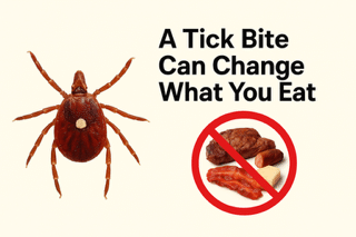 A tick bite can change what you eat